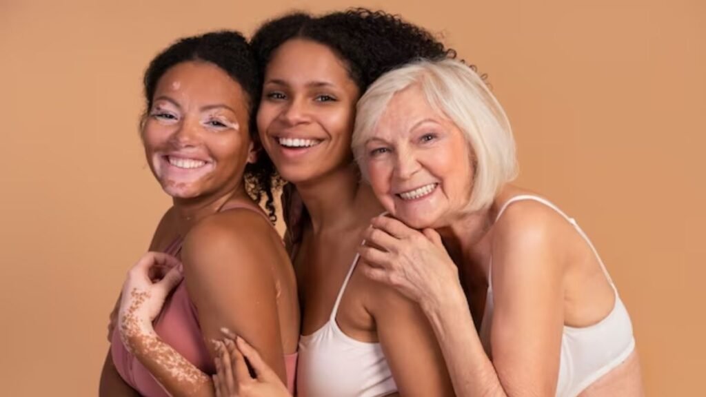 World Vitiligo Day